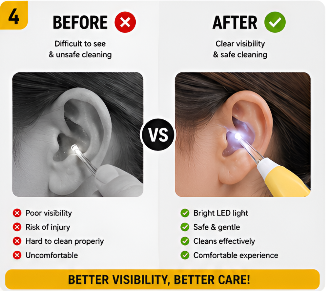 LED Flashlight Ear Pick Set – Reusable Ear Wax Removal Cleaner Kit