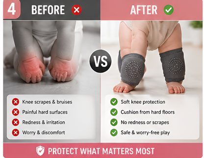Baby Crawling Knee Protector Pads – 4 Pair Set